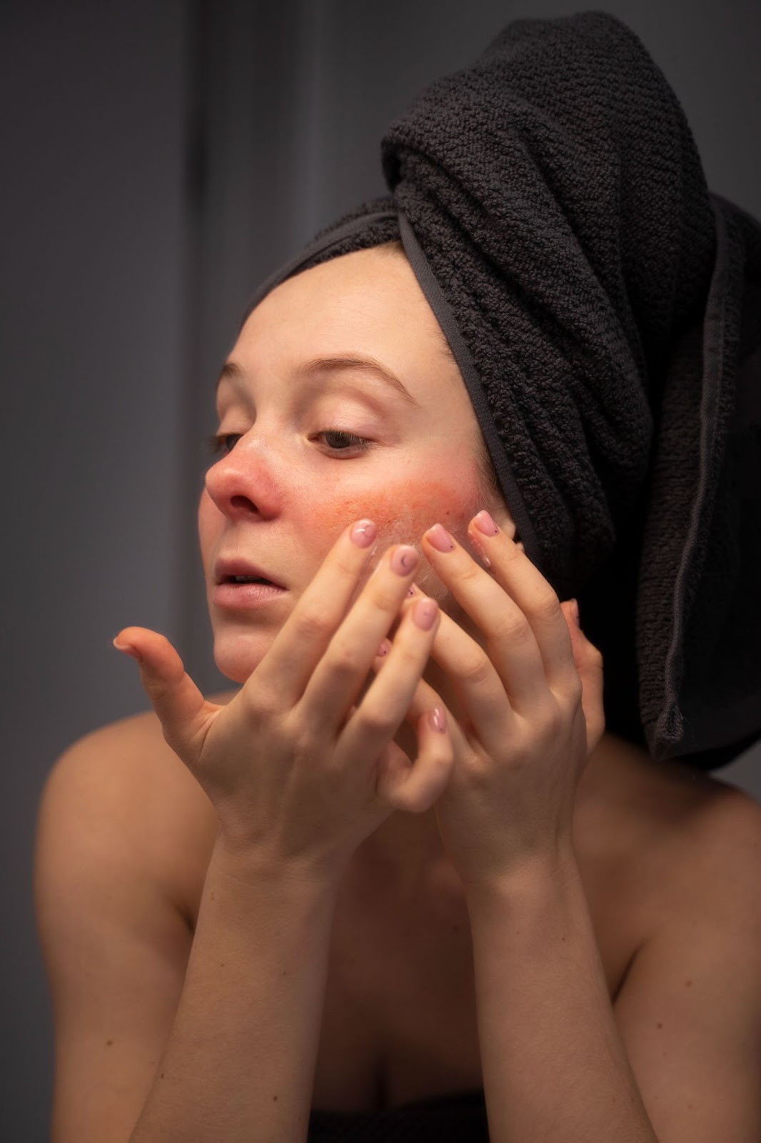 How to Get Rid of Rosacea Quickly?: Here’s the Answer!
